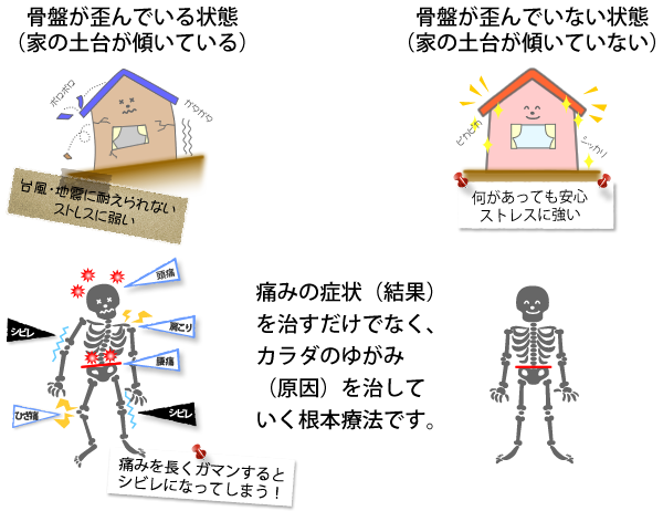 高尿酸は勃起不全を引き起こす可能性があります